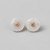 1-Hole Shank Buttons BUTT-WH20002-30B-1